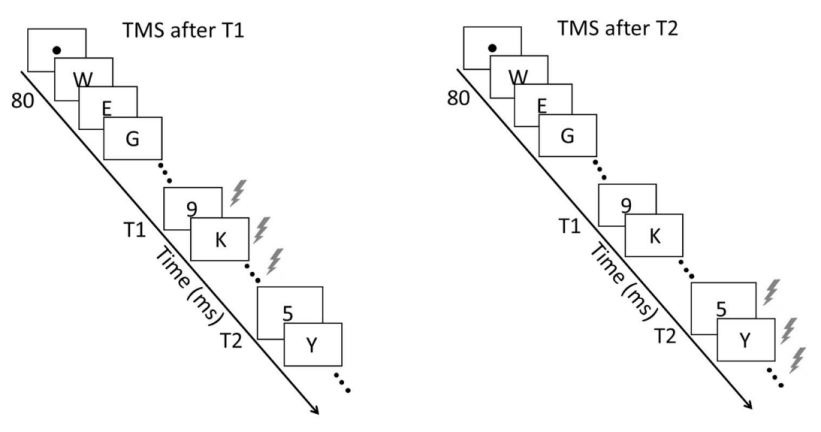 rTMS實驗刺激及流程示意圖